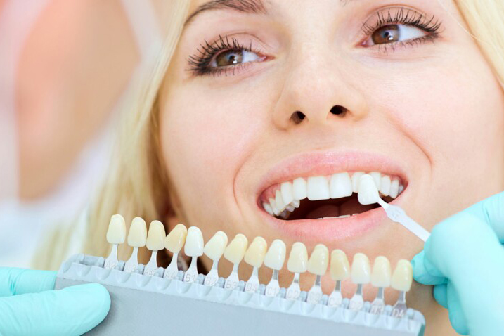 esthétique sourire lyon dents blanches
